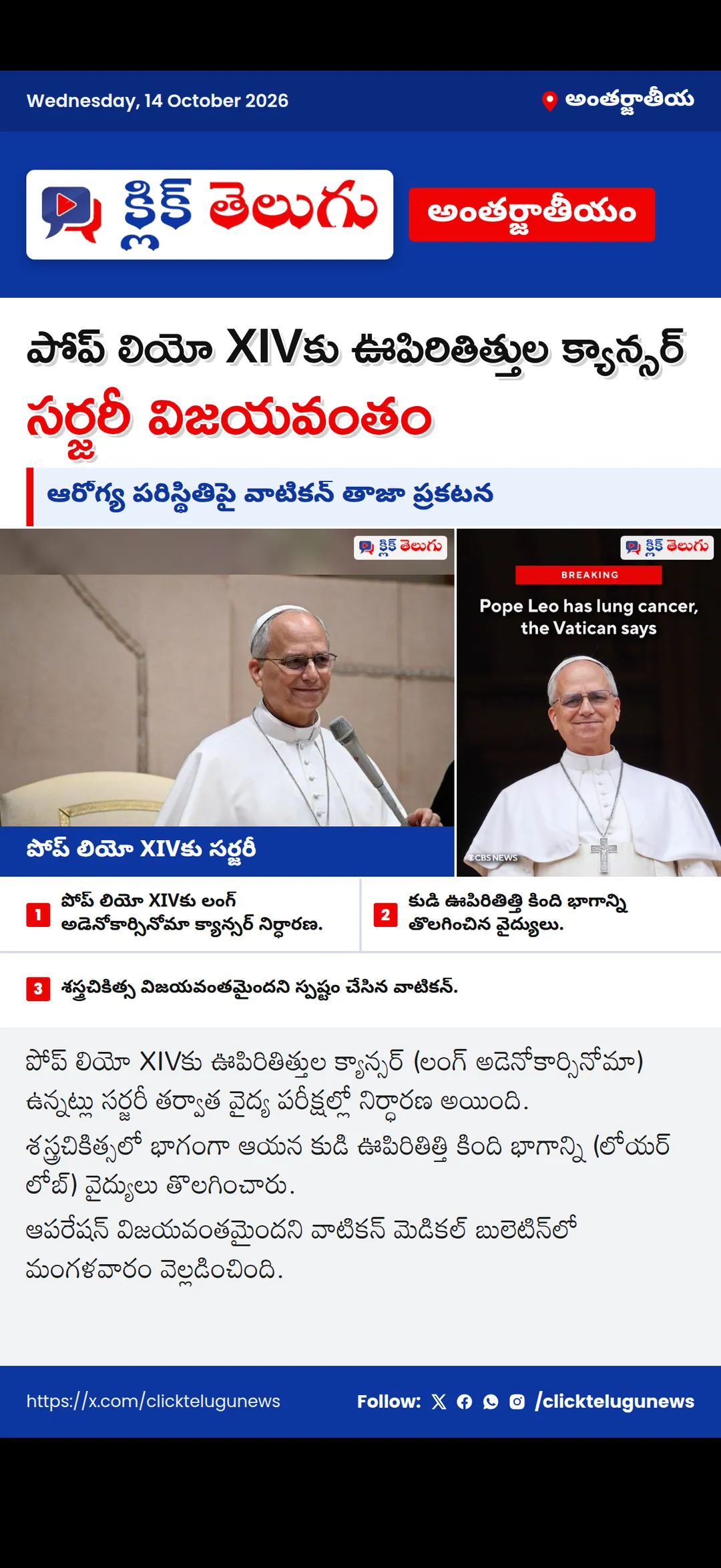 పోప్ లియో XIVకు ఊపిరితిత్తుల క్యాన్సర్.. సర్జరీ విజయవంతం